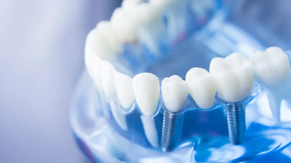 Praxis für digitale Zahnmedizin Implantologie in Bad Ems